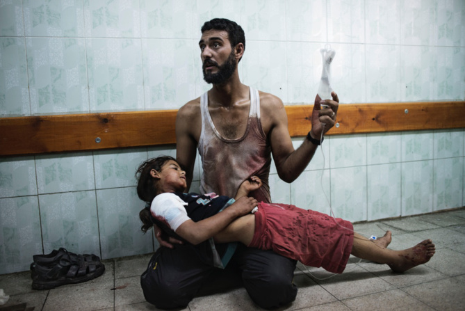 A Palestinian man holds a girl injured during shelling at a U.N.-run school sheltering Palestinians, at a hospital in the northern Gaza Strip on July 24, 2014. Alessio Romenzi for TIME
